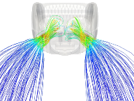 Computational fluid dynamics